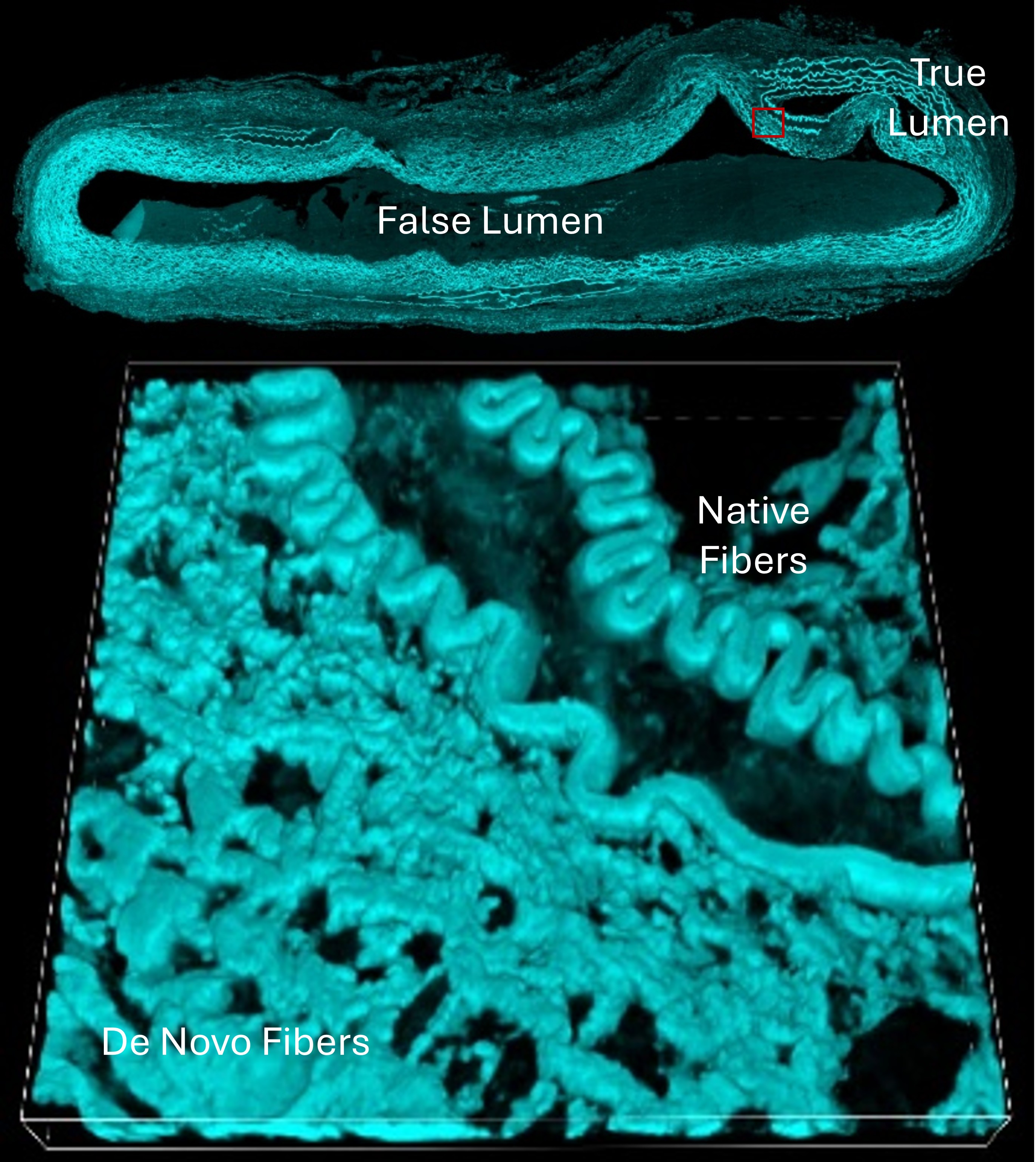 Elastic Fiber Regeneration